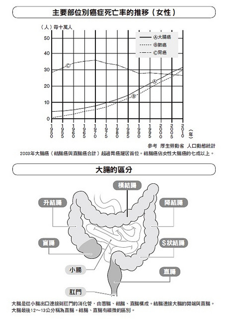 大腸癌的早期癥狀與病程 生活習(xí)慣是預(yù)防關(guān)鍵