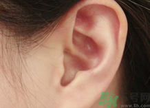 耳朵爬進(jìn)蟲(chóng)子怎么辦?耳朵爬進(jìn)蟲(chóng)子是什么感覺(jué)?.png