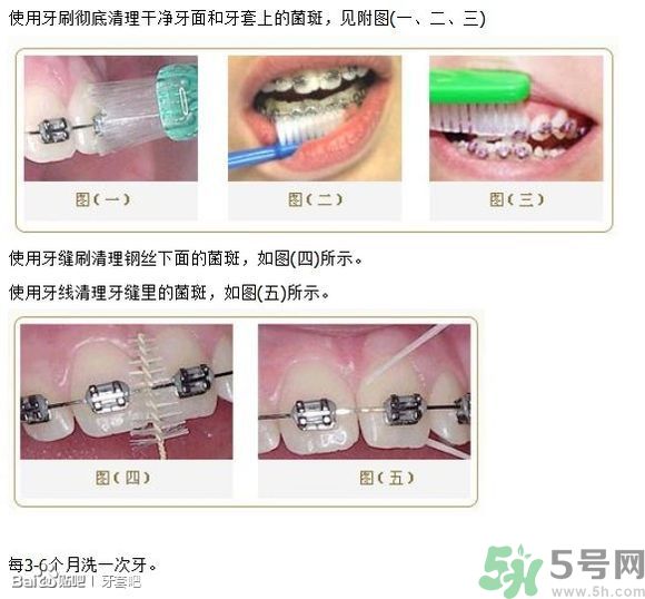 18歲還能戴牙套嗎？戴牙套真的能瘦臉改變臉型嗎？