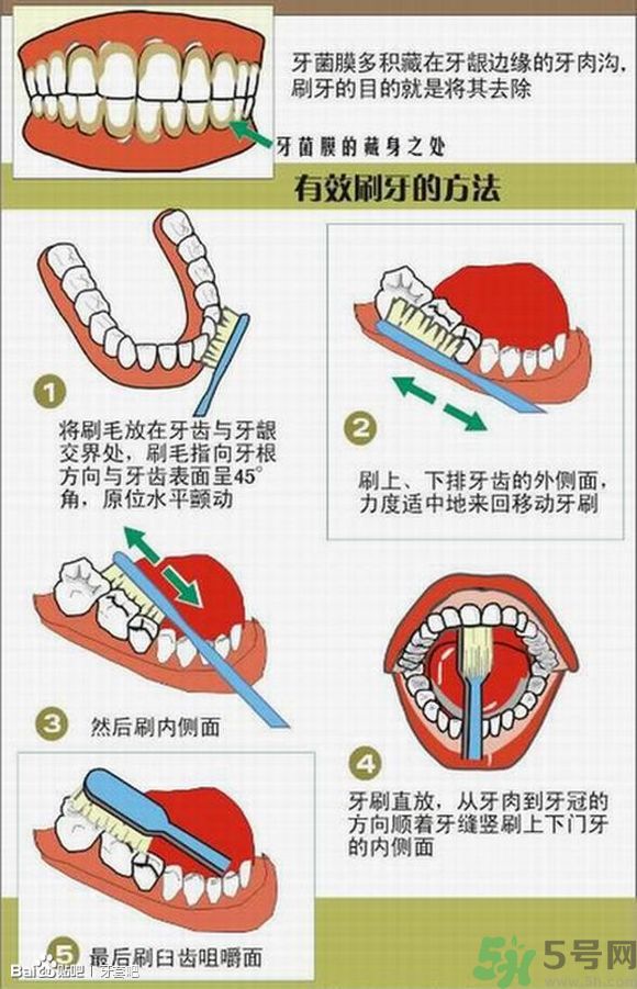 18歲還能戴牙套嗎？戴牙套真的能瘦臉改變臉型嗎？