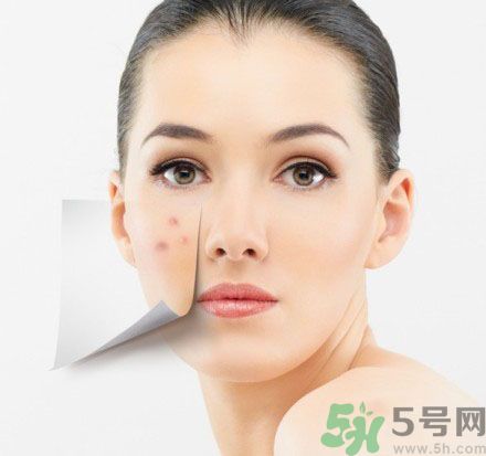 臉上有斑怎么去除？祛斑的小偏方有哪些？