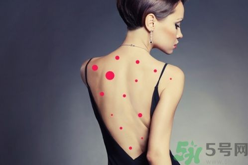 背上為什么會(huì)長痘痘？長痘痘怎么辦？