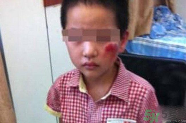 男孩遭校長暴打的結(jié)果是什么？男孩遭校長暴打的真相是什么？