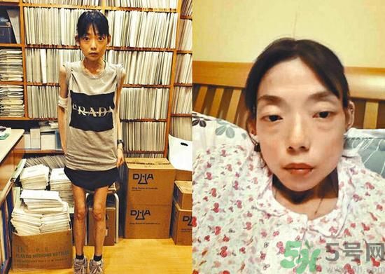 富二代離婚娶二線女星前妻瘦成骷髏  怎么選擇有責(zé)任的男人？