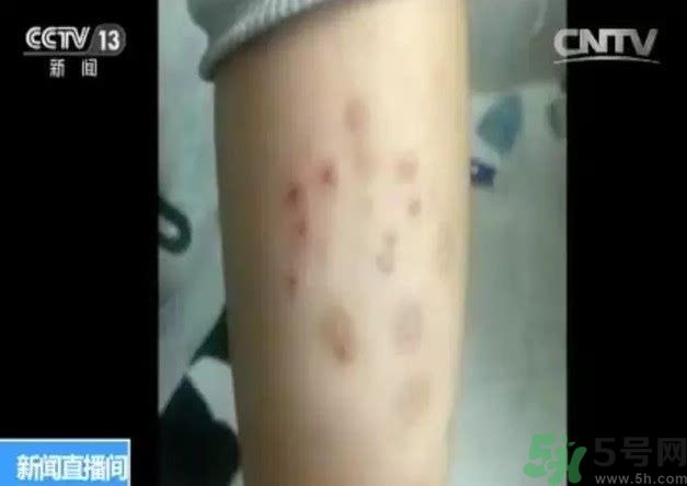 被污染學(xué)校是哪個？500師生患病的原因？