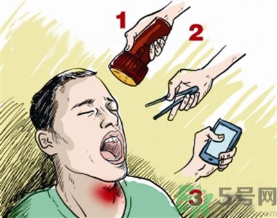 魚(yú)刺卡喉喝醋可以治療嗎？魚(yú)刺卡喉喝醋好不好？