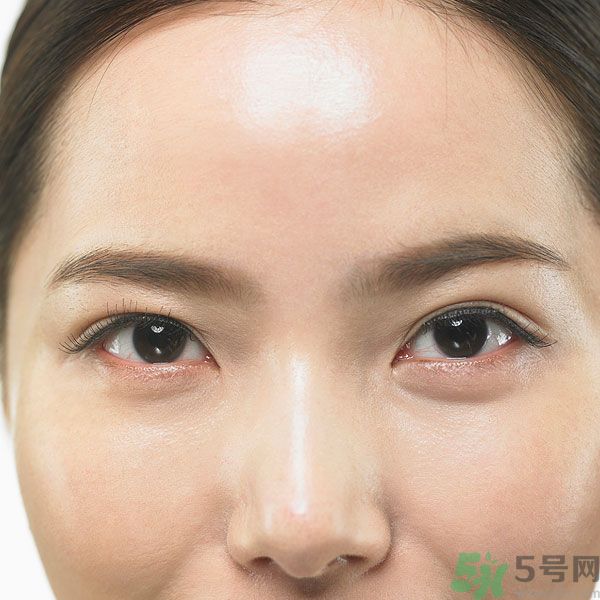 眉周紋是怎么形成的？眉周紋怎么去除？