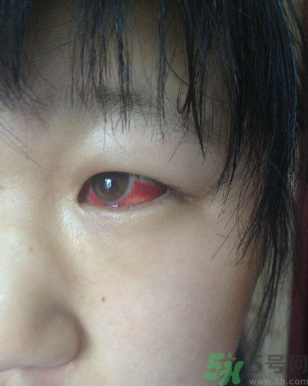 初中生全體甲醛中毒是怎么回事？初中生全體甲醛中毒是哪個學(xué)校？