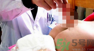 幼童屁股長(zhǎng)出尾巴的原因是什么？孕婦缺什么幼童屁股長(zhǎng)出尾巴？