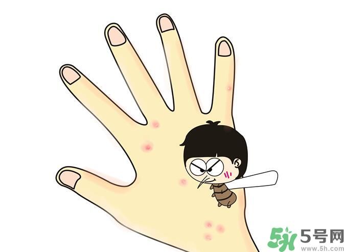 蚊子叮的包過幾天又癢是為什么？蚊子叮的包過幾天又癢怎么辦？