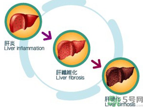 在外面吃飯會得乙肝嗎？在食堂吃飯會得乙肝嗎？