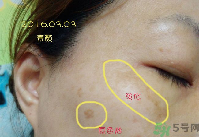 sk2祛斑精華怎么樣？skii祛斑精華使用方法