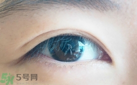 單眼皮怎么變雙眼皮了？單眼皮上面有一條線