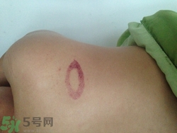 種草莓吻痕是什么意思？吻痕是怎么弄出來的？