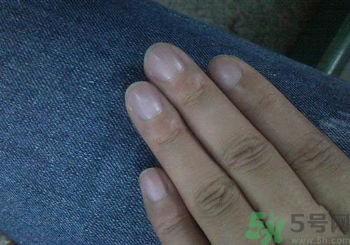 指甲發(fā)紫是什么原因？指甲發(fā)紫是怎么回事？