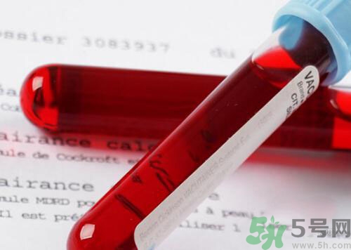 獻(xiàn)血后可以洗澡嗎？抽血后可以洗澡嗎？