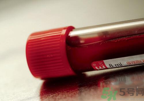獻(xiàn)血后可以洗澡嗎？抽血后可以洗澡嗎？