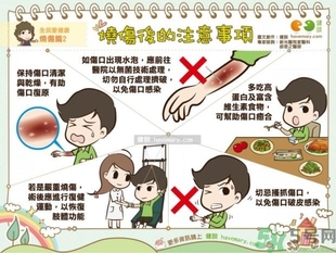 手被油燙傷了怎么處理？手被油燙起泡了怎么辦？