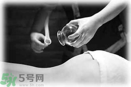 大暑可以拔罐嗎？大暑拔罐好不好？