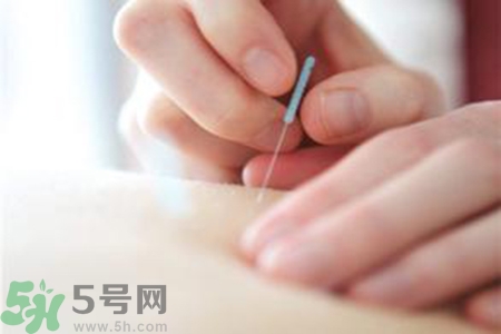 大暑可以針灸嗎？大暑針灸好不好？