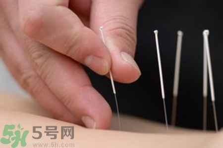 大暑可以針灸嗎？大暑針灸好不好？