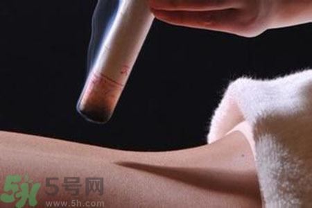 大暑可以艾灸嗎？大暑艾灸的好處有哪些？