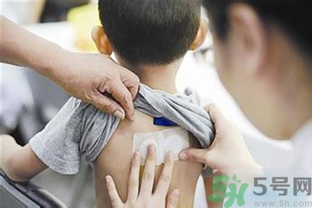 肝炎貼三伏貼有用嗎？肝病貼三伏貼貼哪里？