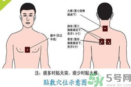 三伏貼能治頸椎病嗎？頸椎病三伏貼穴位