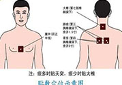 腰痛貼三伏貼有用嗎？腰痛三伏貼貼哪個(gè)穴位？