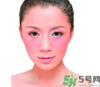 敏感性皮膚用什么洗面奶？敏感性皮膚怎么修復(fù)？