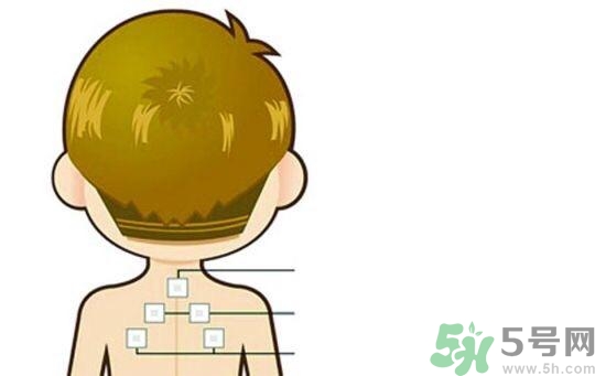 貼三伏貼可以吹空調(diào)嗎？貼完三伏貼多久后可以吹空調(diào)？
