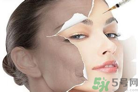 美白針效果怎么樣？美白針有副作用嗎？