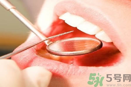 冷光美白牙齒是什么？冷光美白牙齒的好處有哪些？