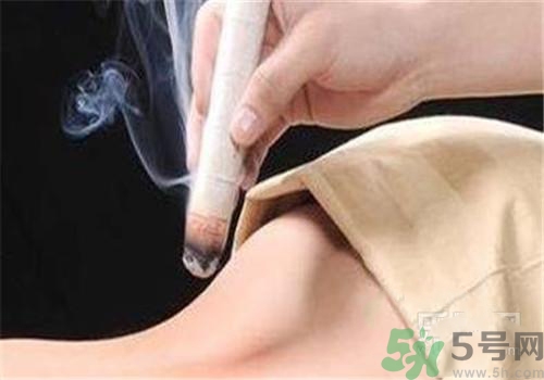 蕁麻疹可以艾灸嗎？蕁麻疹艾灸哪個穴位？