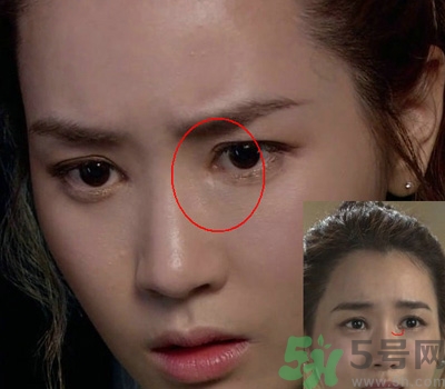 開眼角多少錢？開眼角有什么危害？