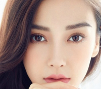 開眼角會留疤嗎？開眼角增生怎么辦？