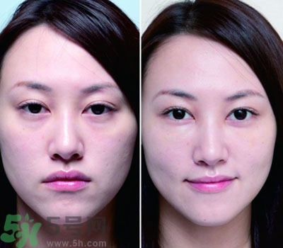 臥蠶是什么？臥蠶是眼袋嗎？