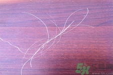 生完寶寶白頭發(fā)的原因？生完寶寶白頭發(fā)怎么辦？