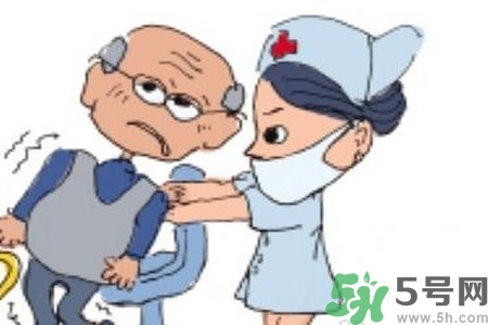 癲癇的典型癥狀有哪些？癲癇是什么？