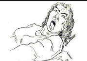 癲癇的發(fā)病因素？癲癇的并發(fā)癥有哪些？