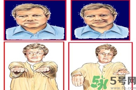 腦中風(fēng)的發(fā)病因素？腦中風(fēng)的并發(fā)癥有哪些 ？