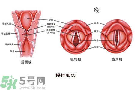 慢性咽炎是什么？慢性咽炎的癥狀有哪些？