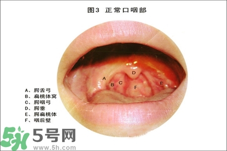 慢性咽炎的治療方法？慢性咽炎的藥物治療？