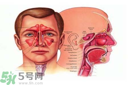 鼻竇炎是什么？鼻竇炎的癥狀有哪些？