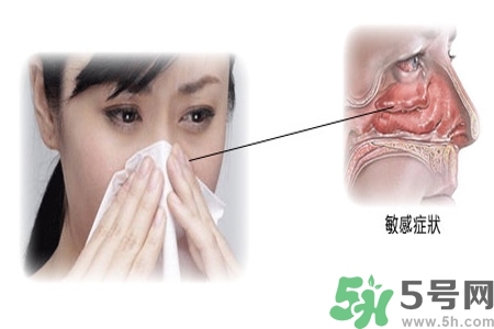 過敏性鼻炎的高發(fā)人群有哪些？如何預防過敏性鼻炎？