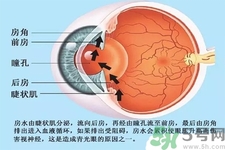 青光眼是什么？青光眼癥狀有什么？