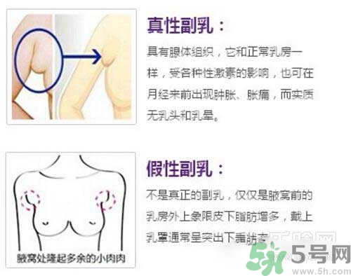 副乳是什么？副乳的危害