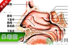 鼻咽癌是什么？鼻咽癌的癥狀有哪些？