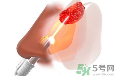 鼻咽癌的日常措施是什么？鼻咽癌注意的飲食有哪些？
