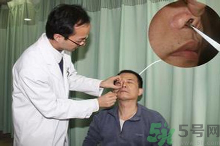 鼻咽癌的治療方法是什么？鼻咽癌可以用什么藥物治療？